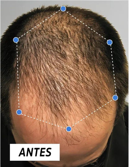 NOVA - Crecimiento del cabello con Péptidos de Cobre III